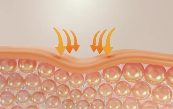 Mengenal Skin Barrier: Kunci Kulit Sehat yang Sering Diabaikan