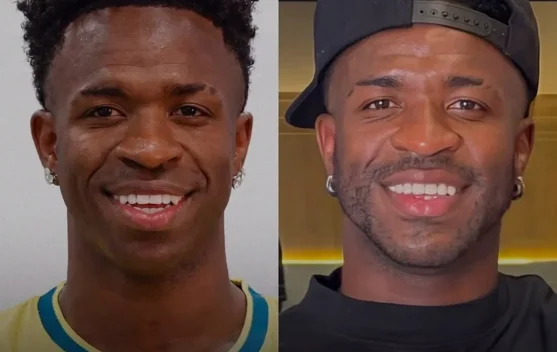 Vinicius Junior Dikabarkan Jalani Harmonisasi Dagu, Penampilan Baru Jadi Sorotan