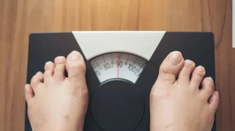 Hasil CKG, Puluhan Ribu Warga Pamekasan Mengalami Obesitas
