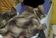 Petasan Kaleng Susu Lukai Dua Remaja di Sampang