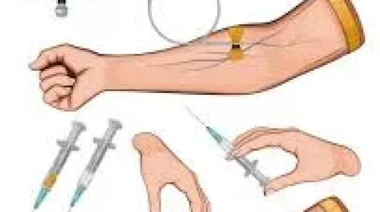 Mekanisme Regenerasi Sistemik Sel Baru melalui Jalur Intravena
