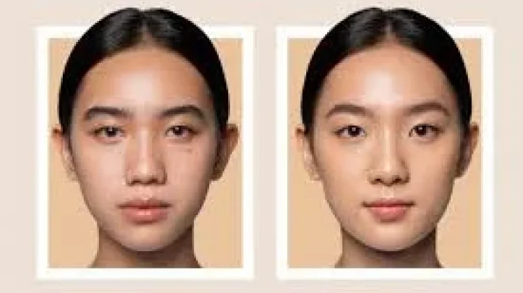 Tranexamic Acid untuk Wajah, Ketahui Manfaat dan Cara Pakai yang Aman