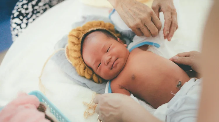 Hernia Umbilicalis, Pusar "Bodong" Menurut Dunia Medis