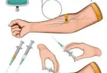 Mekanisme Regenerasi Sistemik Sel Baru melalui Jalur Intravena