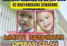 Polda Jateng Gelar Operasi Gratis Celah Bibir dan Lelangit di Semarang