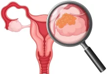 Kanker Serviks, Ancaman Kesehatan Perempuan Indonesia