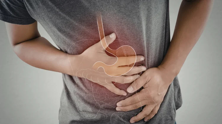 Punya GERD? Nggak Perlu Khawatir saat Puasa