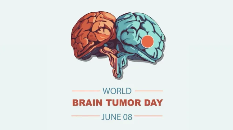 Hari Tumor Otak Sedunia, Simak Latar Belakang Peringatannya