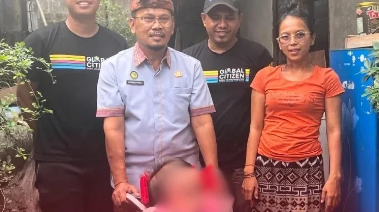 Dinsos P3A Buleleng Salurkan Kursi Roda bagi Balita Disabilitas