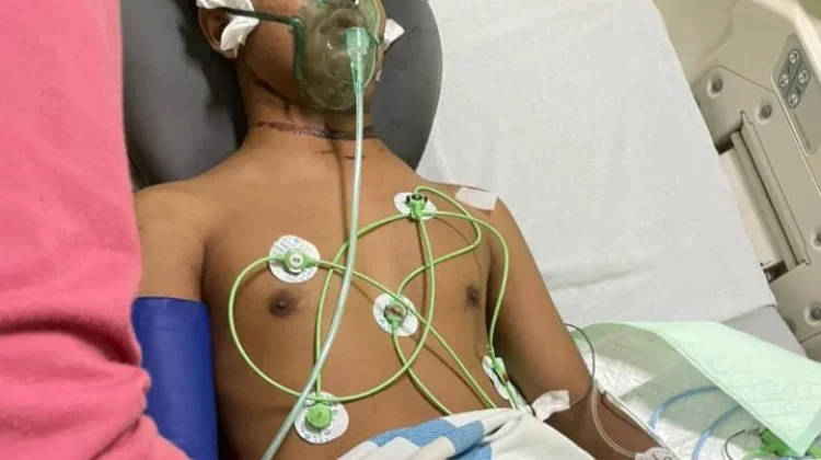 DPRD Jembrana Dorong Penataan Kabel Internet usai Makan Korban