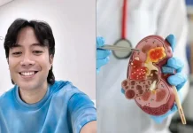Mengenal Kanker Ginjal yang Diderita Almarhum Vidi Aldiano sejak 2019
