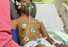 DPRD Jembrana Dorong Penataan Kabel Internet usai Makan Korban
