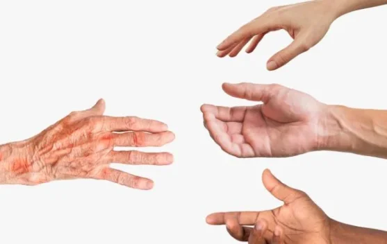 Jejak Kuburan Kusta, Menghapus Warisan Stigma