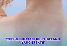 Tips Mengatasi Kulit Belang yang Efektif