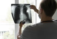 Kanker Paru Silent Killer, Deteksi Dini Tingkatkan Peluang Kesembuhan