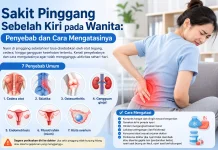 Jangan Diabaikan, Ini Penyebab Sakit Pinggang Sebelah Kiri pada Wanita