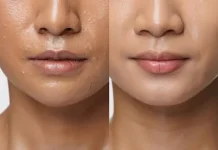 Tips Mencerahkan Bibir Gelap