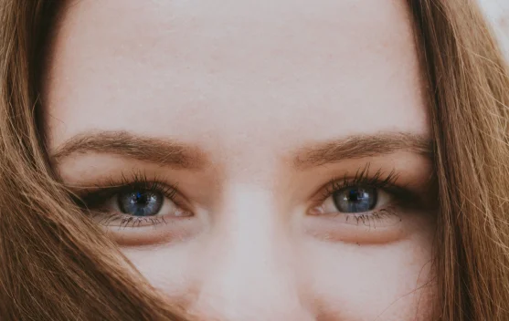 Cara Mengatasi Mata Sembab