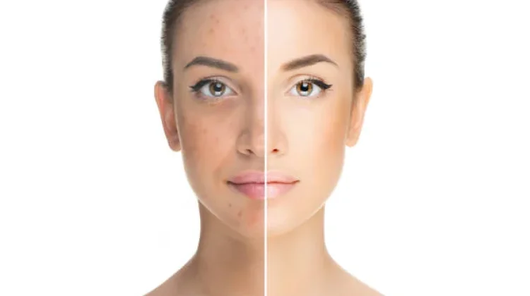 5 Alasan Muka Glowing di Pagi Hari dan Sore Menjadi Kusam