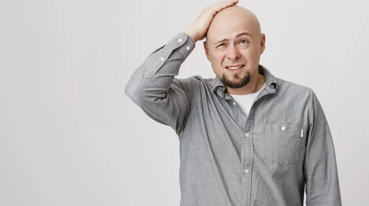 Mengenal Alopesia, Penyakit yang Menyebabkan Rambut Rontok