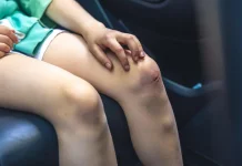 Gatal pada Luka Sembuh ternyata Bagian Proses Pemulihan Tubuh
