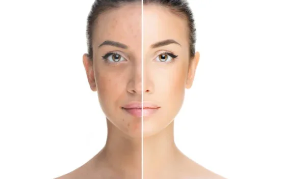 5 Alasan Muka Glowing di Pagi Hari dan Sore Menjadi Kusam