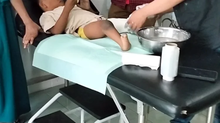 Kolaborasi Kemanusiaan Bantu Irsya Wujudkan Impian Gunakan Kaki Palsu