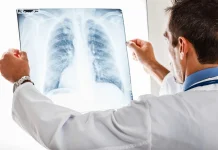 Hidup Berdampingan dengan Radiasi, Mengapa Pemeriksaan Medis Tetap Aman?