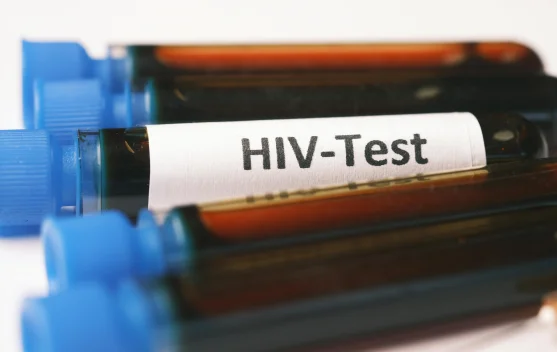 Brasil Berhasil Hentikan Penularan HIV dari Ibu ke Anak, Tonggak Penting Kesehatan