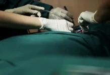 Bedah Minim Invasif di RS Milik Pemerintah Dapat Ditanggung BPJS