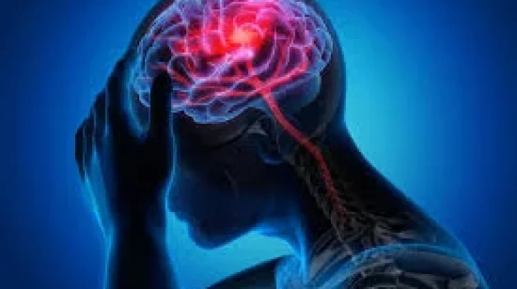 5 Gejala Ringan Ini menjadi Tanda Stroke yang Harus Diwaspadai
