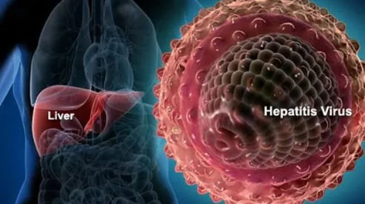 Gejala Hepatitis yang Harus Dikenali sejak Dini untuk Cegah Komplikasi