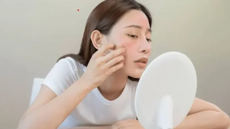 Jerawat Sering Muncul? Ini Cara Memperbaiki Skin Barrier agar Kulit Lebih Sehat