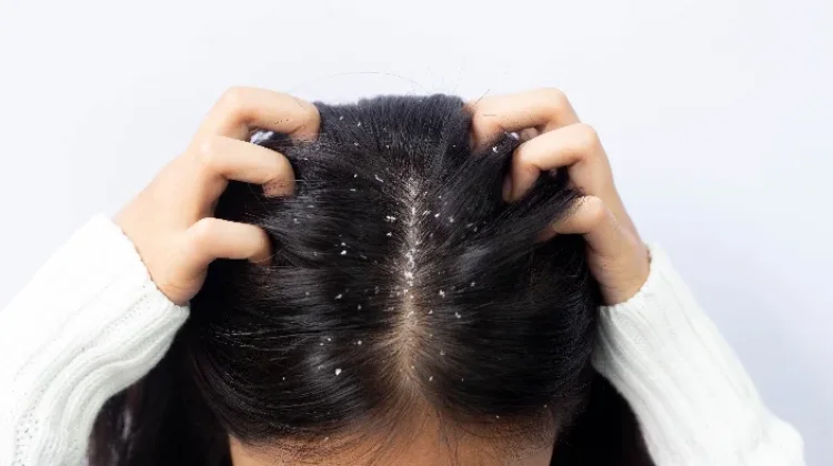 Manfaat Minyak Kelapa untuk Rambut dan Cara Penggunaannya