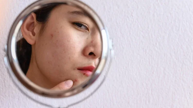 Skin Barrier Terganggu? 7 Kebiasaan Ini Bisa Membantu Kulit Kembali Nyaman