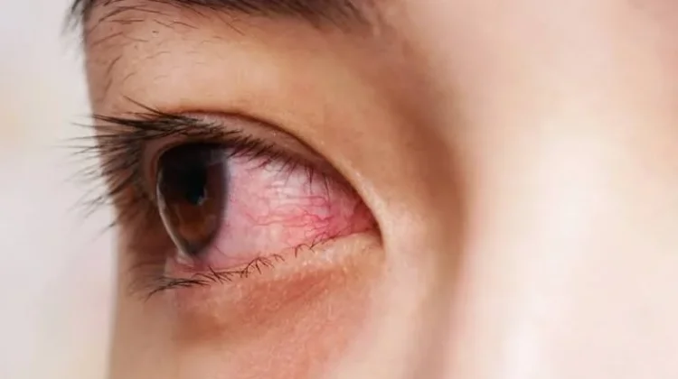 Beragam Penyakit Retina Mata yang Perlu Anda Ketahui