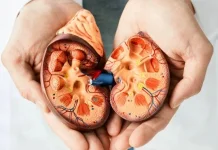 Clear Cell Renal Cell Carcinoma: Kanker Ginjal yang Menyerang Vidi Aldiano