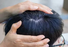 Penyebab Rambut Berubat diusia Muda