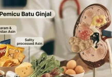 3 Makanan Harian Ini Jadi Pemicu Batu Ginjal
