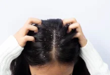 Manfaat Minyak Kelapa untuk Rambut dan Cara Penggunaannya