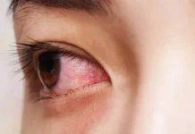 Beragam Penyakit Retina Mata yang Perlu Anda Ketahui