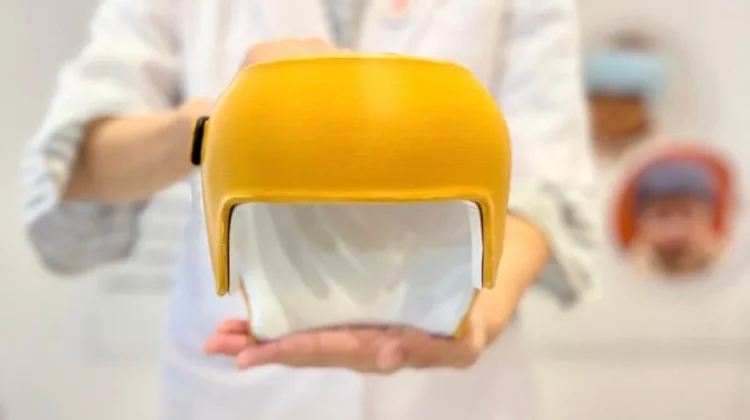Helm Ortopedi untuk Anak: Inovasi Medis untuk Mengatasi Kepala Peyang pada Bayi