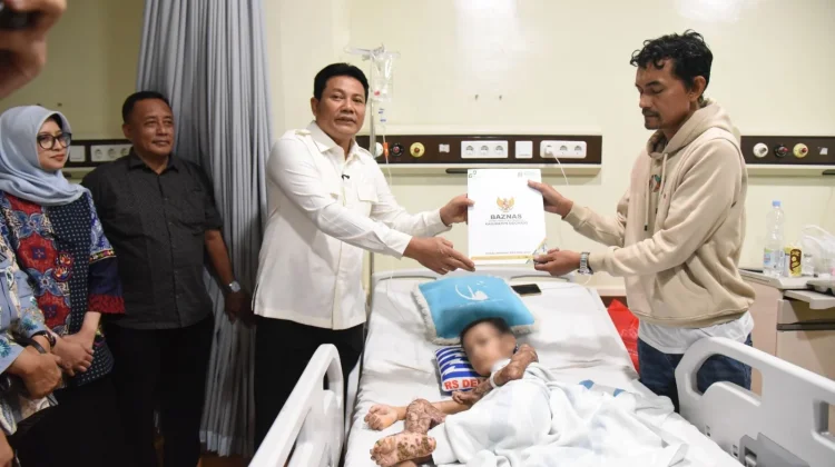 Pemkab Sidoarjo Tanggung Pengobatan Bocah Korban Kebakaran
