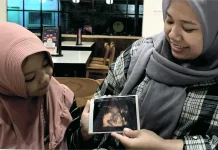 Ibu Hamil Merapat, Simak Kapan Waktu yang Tepat untuk USG 4D
