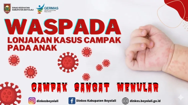 Waspada Campak, Dinkes Sragen Temukan 10 Kasus Suspek hingga April 2026