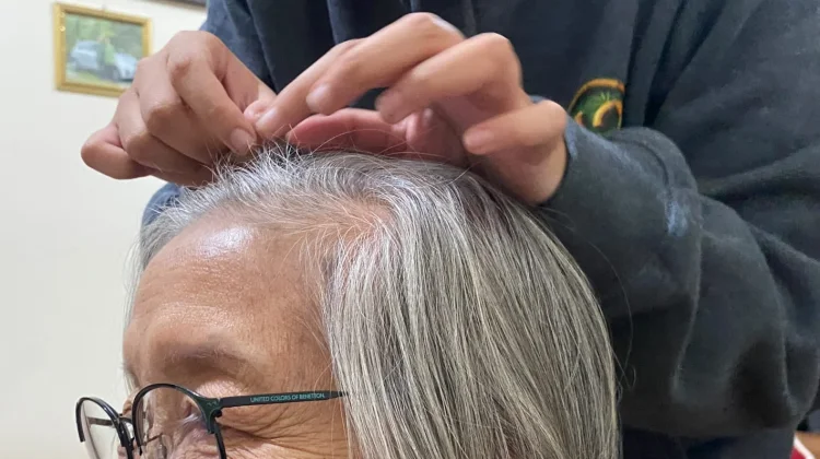 Dokter Ingatkan Mencabut Uban Berisiko Rusak Folikel Rambut