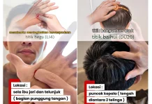 Titik Akupresur Sederhana untuk Mengurangi Kantuk saat Berkendara