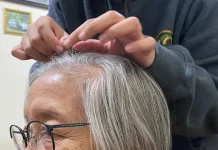 Dokter Ingatkan Mencabut Uban Berisiko Rusak Folikel Rambut