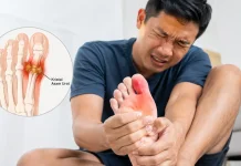 Gejala Asam Urat dan Cara Pencegahannya
