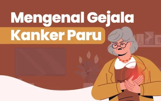 Waspada Kanker Paru